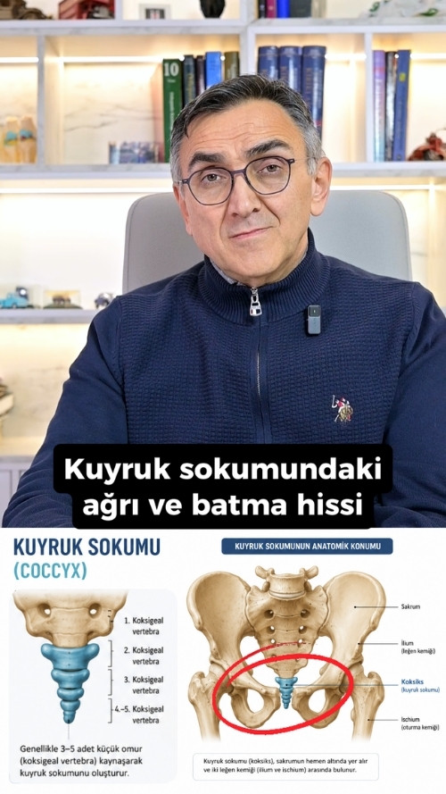 Yıllar sonra başlayan kuyruk sokumunda ağrı ve batma hissi